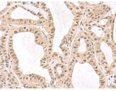 兔抗RPS6KA5多克隆抗体