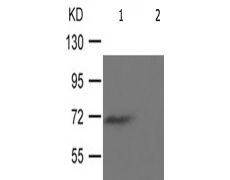 兔抗RPS6KB1(Phospho-Thr229) 多克隆抗体