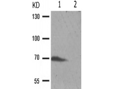兔抗RPS6KB1(Phospho-Thr389/412) 多克隆抗体
