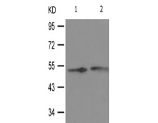 兔抗RPS6KB2(Phospho-Ser423) 多克隆抗体