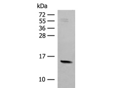 兔抗RPS12多克隆抗体