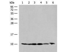 兔抗RPS28多克隆抗体