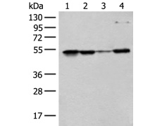 兔抗RRP1多克隆抗体