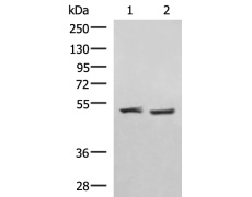 兔抗RRP8多克隆抗体