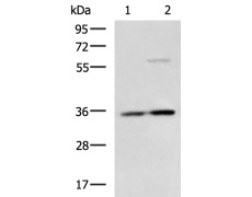 兔抗RWDD1多克隆抗体