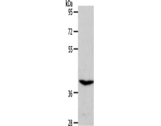 兔抗S1PR4多克隆抗体