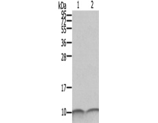 兔抗S100A6多克隆抗体