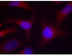 兔抗NFKBIA (Phospho-Ser32 Ser36)多克隆抗体