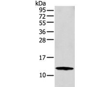 兔抗S100A16多克隆抗体