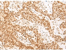 兔抗NHP2多克隆抗体