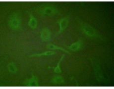 兔抗SCGB2A2多克隆抗体