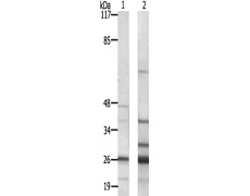 兔抗SCN4B多克隆抗体 