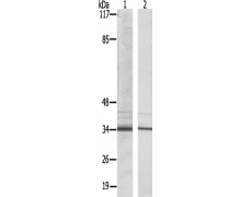  兔抗NKX6-3多克隆抗体 ​