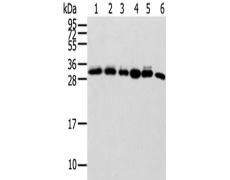 兔抗SENP8多克隆抗体