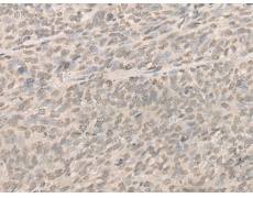 兔抗NR1I3多克隆抗体