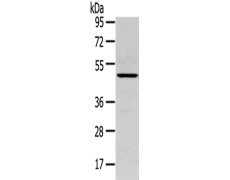 兔抗SERPINB11多克隆抗体