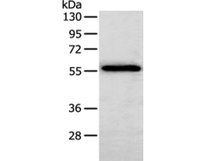 兔抗SERPINF2多克隆抗体
