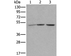 兔抗NUDCD3多克隆抗体