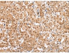 兔抗NUDCD3多克隆抗体