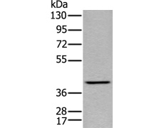 兔抗SH3GLB1多克隆抗体