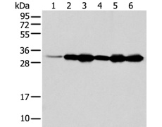 兔抗NUDT22多克隆抗体