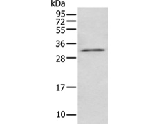 兔抗NUDT5多克隆抗体
