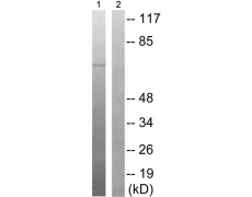 兔抗OXSR1(Phospho-Thr185)多克隆抗体