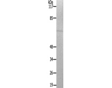 兔抗PAK1(Ab-204)多克隆抗体
