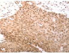 兔抗PARP1(cleaved)多克隆抗体