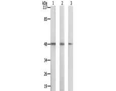 兔抗SIRPB1多克隆抗体