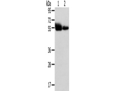 兔抗SLC1A1多克隆抗体