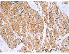 兔抗SLC4A3多克隆抗体