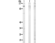 兔抗SLC4A11多克隆抗体