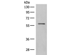 兔抗SLC5A1多克隆抗体