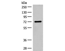 兔抗SLC6A11多克隆抗体