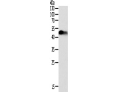 兔抗SLC12A1多克隆抗体