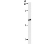兔抗SLC16A4多克隆抗体