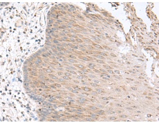 兔抗SLC16A14多克隆抗体