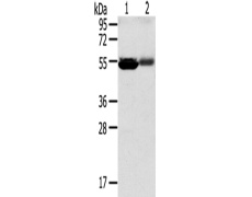兔抗SLC17A1多克隆抗体