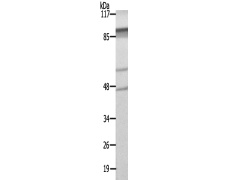 兔抗SLC17A2多克隆抗体