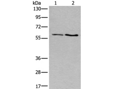 兔抗SLC17A8多克隆抗体