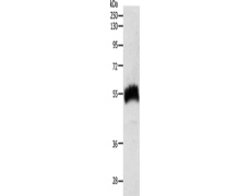 兔抗SLC22A6多克隆抗体