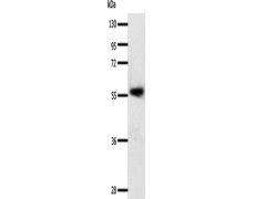 兔抗SLC22A17多克隆抗体