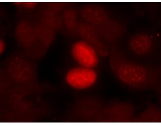 兔抗FOXO1 (Phospho-Ser256)多克隆抗体