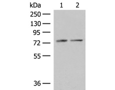 兔抗PDIA4多克隆抗体