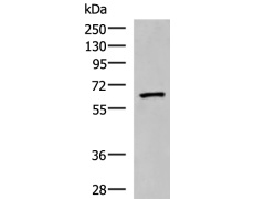 兔抗PDIA5多克隆抗体