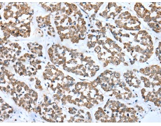 兔抗FSD1L多克隆抗体