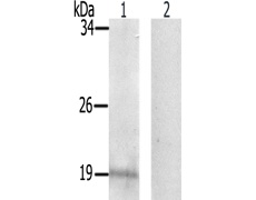 兔抗PEA15(Phospho-Ser104)多克隆抗体
