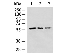 兔抗PGM3多克隆抗体