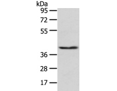兔抗PHKG1多克隆抗体